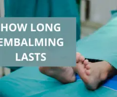 How Long Does Embalming Last